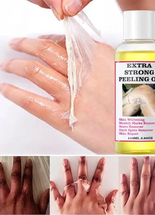 زيت التقشير الأصفر