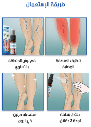 بخاخ علاج الدوالي