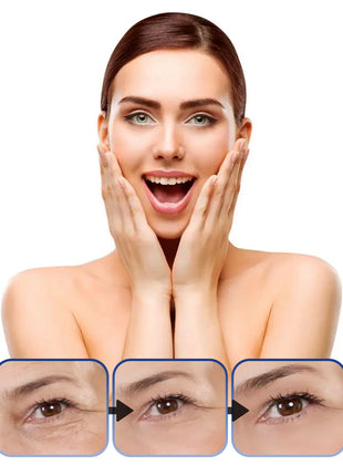 مصل البوتوكس المضاد للتجاعيد وشد بشرة الوجه