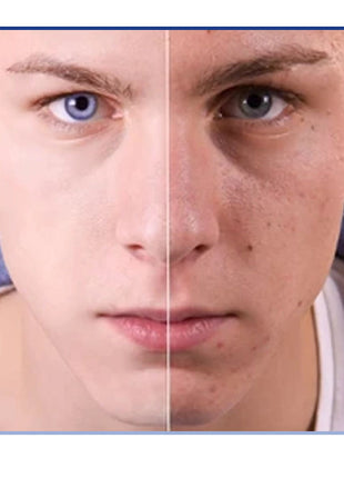 مصل البوتوكس المضاد للتجاعيد وشد بشرة الوجه