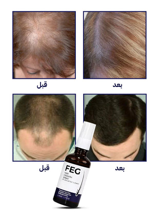 بخاخ علاج تساقط الشعر